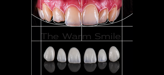 Composite Bonding vs. Other Techniques: Choosing the Right Cosmetic Solution