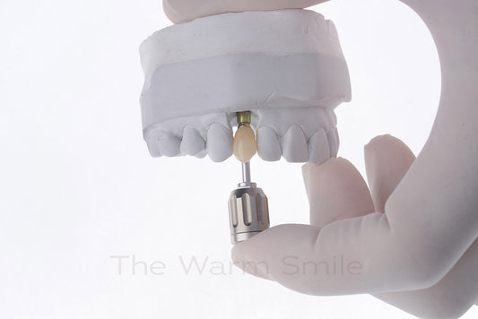 Advantages of Dental Implants